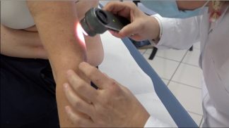 Mappatura dei nei, l’Ulss Dolomiti presenta le novità